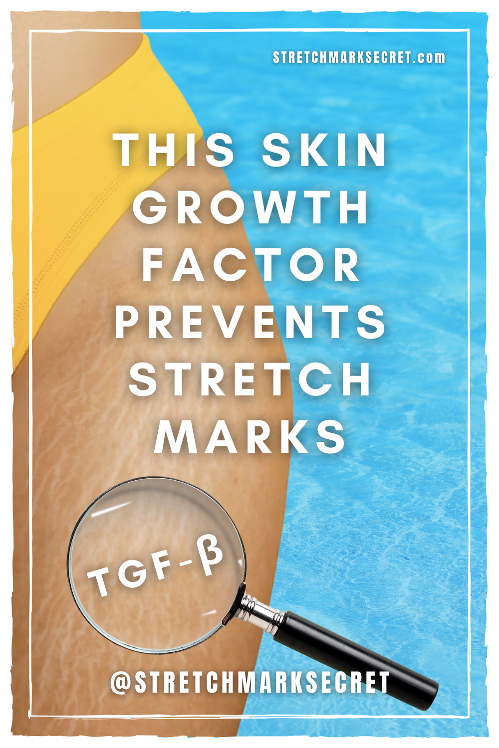 This Skin Growth Factor Prevents Stretch Marks